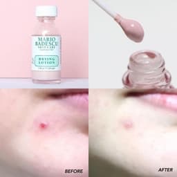 Chấm Mụn Mario Badescu Drying Lotion 29ml