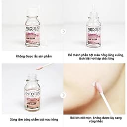 CHẤM MỤN NEOGEN