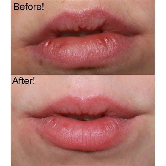 TẨY TBC MÔI BEAUTY TREATS LIP SCRUB