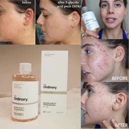 TONER THE ORDINARY GLYCOLIC ACID 7%